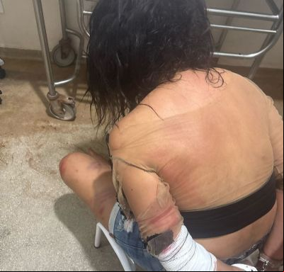 Surtada, mulher nua tenta atacar moradores com caco de vidro em Vila Rica (MT)