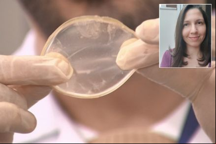 UFMT testa curativo para queimadura feito de babosa e pr